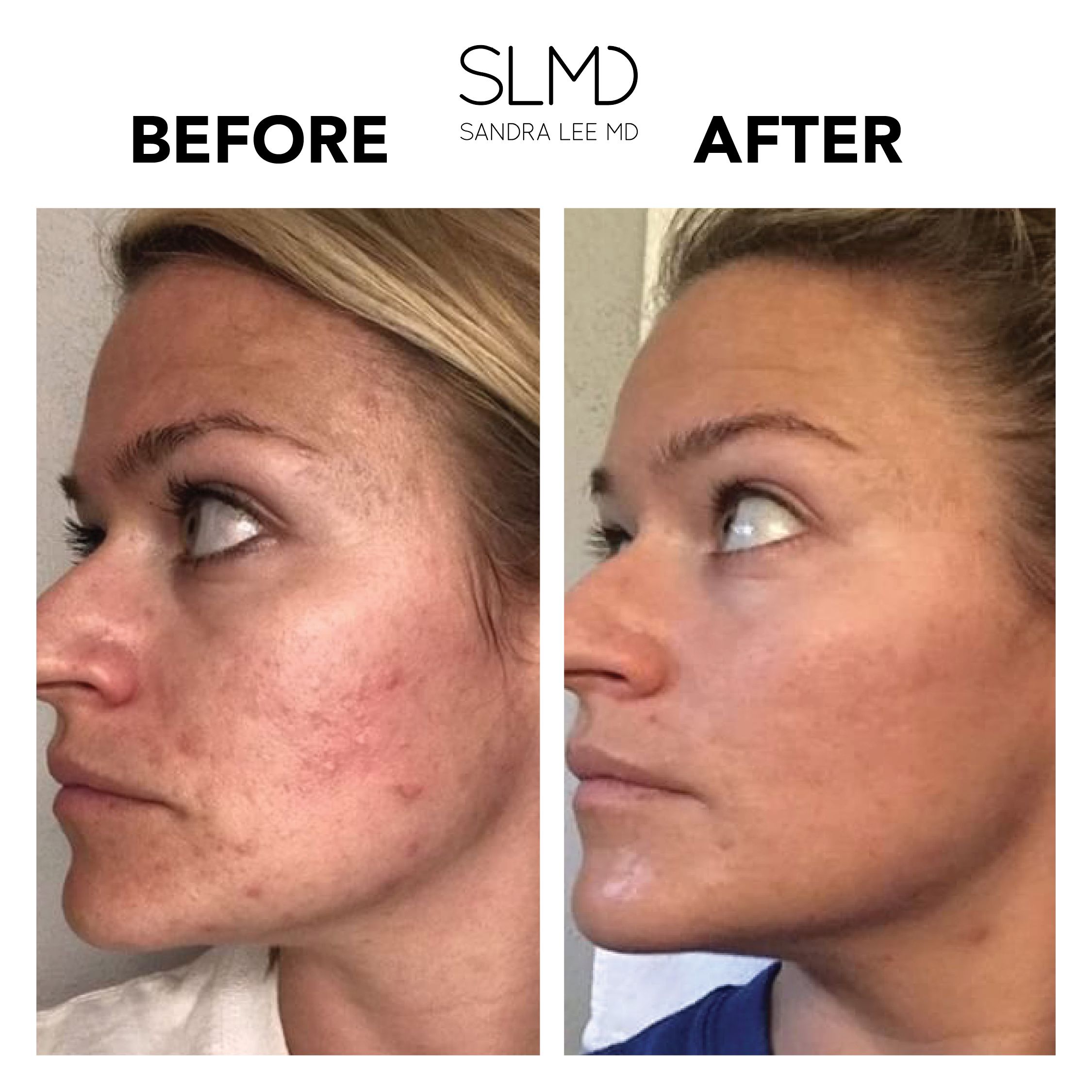 SLMD Skincare Ürünleri